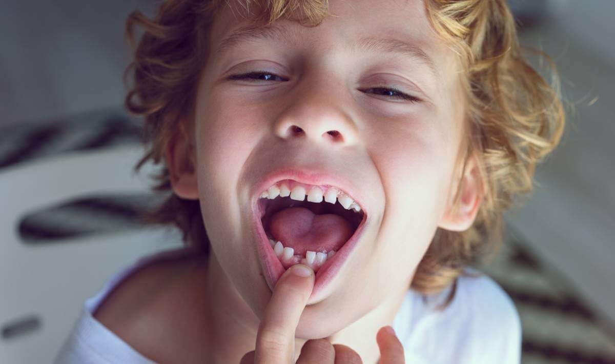 Pierwsze wypadające zęby u małego dziecka